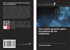 Una visión general sobre los pilares de los implantes kitap kapağı