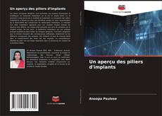 Bookcover of Un aperçu des piliers d'implants