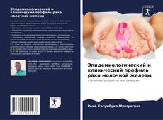 Эпидемиологический и клинический профиль рака молочной железы的封面