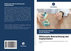 Capa do livro de Okklusale Betrachtung bei Implantaten 