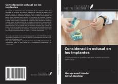 Copertina di Consideración oclusal en los implantes