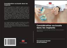 Bookcover of Considération occlusale dans les implants