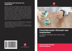 Buchcover von Consideração Oclusal nos Implantes