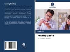 Capa do livro de Periimplantitis 