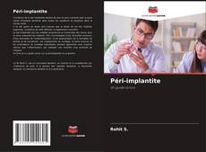 Portada del libro de Péri-implantite