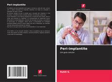 Peri-implantite的封面