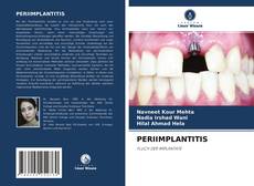 Bookcover of PERIIMPLANTITIS