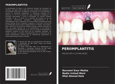 Couverture de PERIIMPLANTITIS