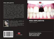 Couverture de PÉRI-IMPLANTITE