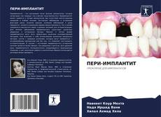 Bookcover of ПЕРИ-ИМПЛАНТИТ