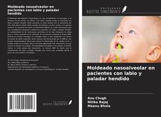 Couverture de Moldeado nasoalveolar en pacientes con labio y paladar hendido