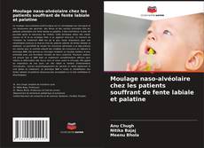 Copertina di Moulage naso-alvéolaire chez les patients souffrant de fente labiale et palatine