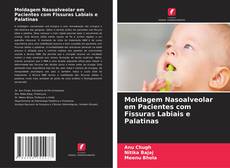 Buchcover von Moldagem Nasoalveolar em Pacientes com Fissuras Labiais e Palatinas