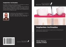 Capa do livro de Implantes inclinados 