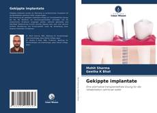 Обложка Gekippte implantate