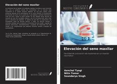 Capa do livro de Elevación del seno maxilar 