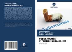 Buchcover von TUBERKULOSE: INFEKTIONSKRANKHEIT