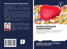 Buchcover von ИНФЕКЦИОННЫЙ ЭНДОКАРДИТ