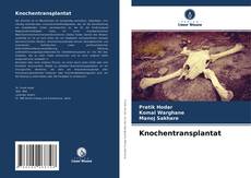 Capa do livro de Knochentransplantat 