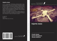 Buchcover von Injerto óseo