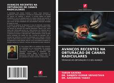 Buchcover von AVANÇOS RECENTES NA OBTURAÇÃO DE CANAIS RADICULARES