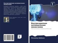 Buchcover von Внутричерепная ангиоматозная менингиома