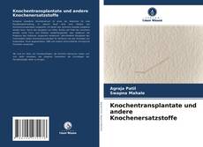 Buchcover von Knochentransplantate und andere Knochenersatzstoffe