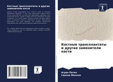 Buchcover von Костные трансплантаты и другие заменители кости