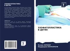 Buchcover von ЭЗОФАГОПЛАСТИКА В ДЕТЯХ