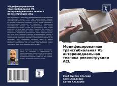 Capa do livro de Модифицированная транстибиальная VS антеромедиальная техника реконструкции ACL 