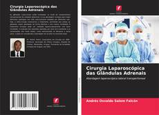 Bookcover of Cirurgia Laparoscópica das Glândulas Adrenais