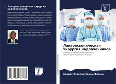Лапароскопическая хирургия надпочечников kitap kapağı