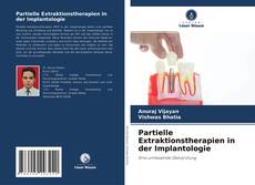 Partielle Extraktionstherapien in der Implantologie kitap kapağı