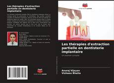 Capa do livro de Les thérapies d'extraction partielle en dentisterie implantaire 