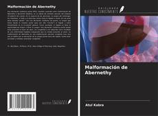 Bookcover of Malformación de Abernethy