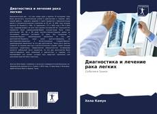Portada del libro de Диагностика и лечение рака легких