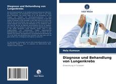 Copertina di Diagnose und Behandlung von Lungenkrebs