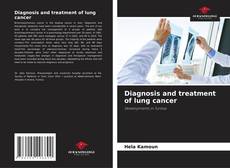 Обложка Diagnosis and treatment of lung cancer