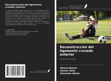 Copertina di Reconstrucción del ligamento cruzado anterior