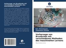 Copertina di Vorhersage von Brustkrebs mit verschiedenen Methoden des maschinellen Lernens