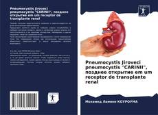 Buchcover von Pneumocystis Jiroveci pneumocystis "CARINII", позднее открытие em um receptor de transplante renal