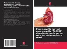 Обложка Pneumocystis Jiroveci pneumocystis "CARINII", descoberta tardia em um receptor de transplante renal