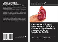 Couverture de Pneumocystis Jiroveci pneumocystis "CARINII", descubrimiento tardío en un receptor de un trasplante de riñón