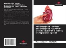 Buchcover von Pneumocystis Jiroveci pneumocystis "CARINII", late discovery in a kidney transplant recipient