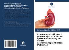 Copertina di Pneumocystis Jiroveci pneumocystis "CARINII", späte Entdeckung bei einem nierentransplantierten Patienten