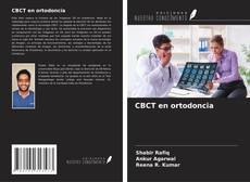 Bookcover of CBCT en ortodoncia
