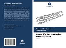 Copertina di Stents für Rupturen des Aortenisthmus