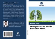 Management von Arbuda gegenüber Krebs的封面