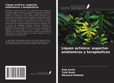 Bookcover of Liquen actínico: aspectos anatómicos y terapéuticos