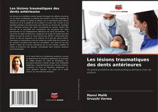 Les lésions traumatiques des dents antérieures的封面